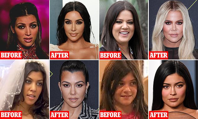 Kardashians-Before-Surgery.jpg