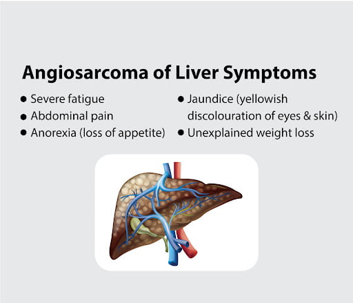 Angiosarcoma-of-liver-symptoms.jpg