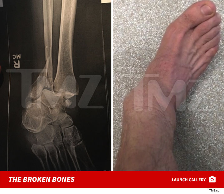 steveo-injury-tmz-excl-launch-jpg-7.jpg