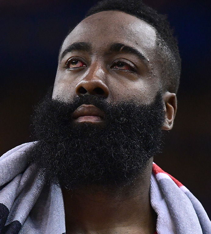 james-harden-eyes-injury-photos-06-1024x768.jpg