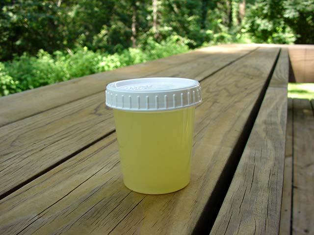 Urine_Sample_00010_IR1.jpg