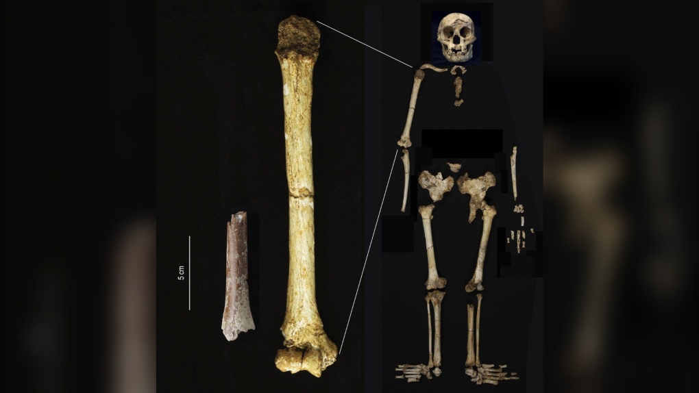 mata-menge-humerus-fragment-1-6990282-1722958585119.jpeg